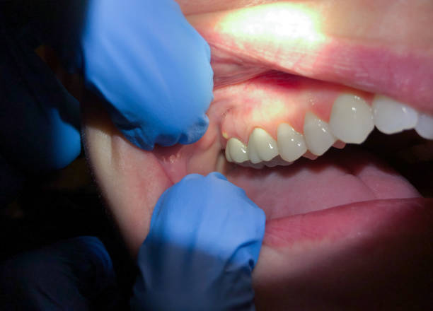 Best Emergency Dental Care for Trauma or Injury in Dalton Gardens, ID